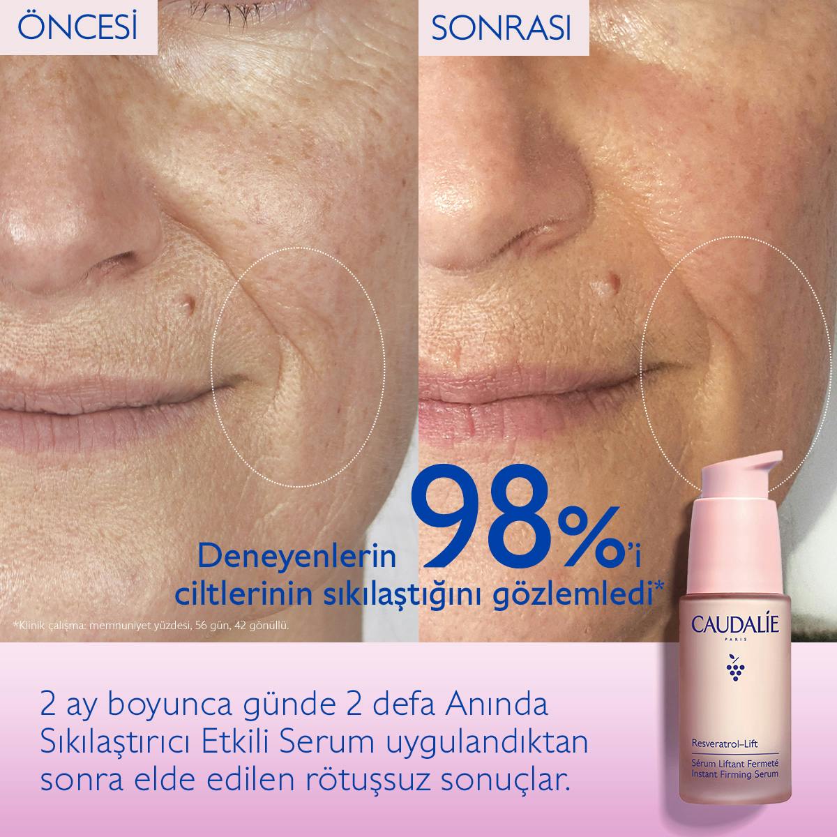 Caudalie Resveratrol Lift Anında Sıkılaştırıcı Serum 30 ml