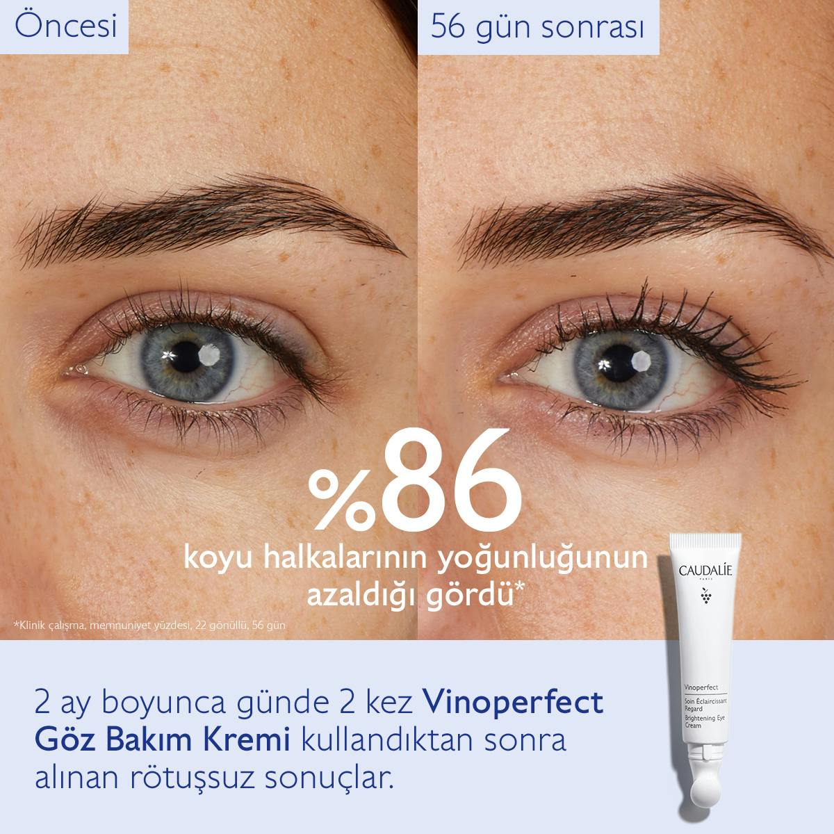 Caudalie Vinoperfect Işıltı Verici Göz Bakım Kremi 15 ml