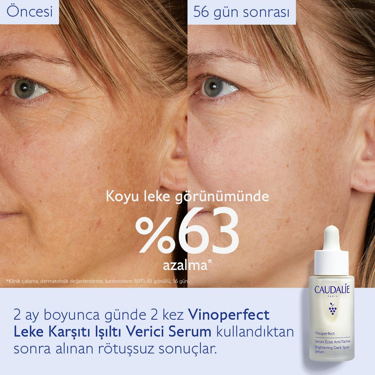 Caudalie Vinoperfect Leke Karşıtı ve Işıltı Verici Serum 30 ml