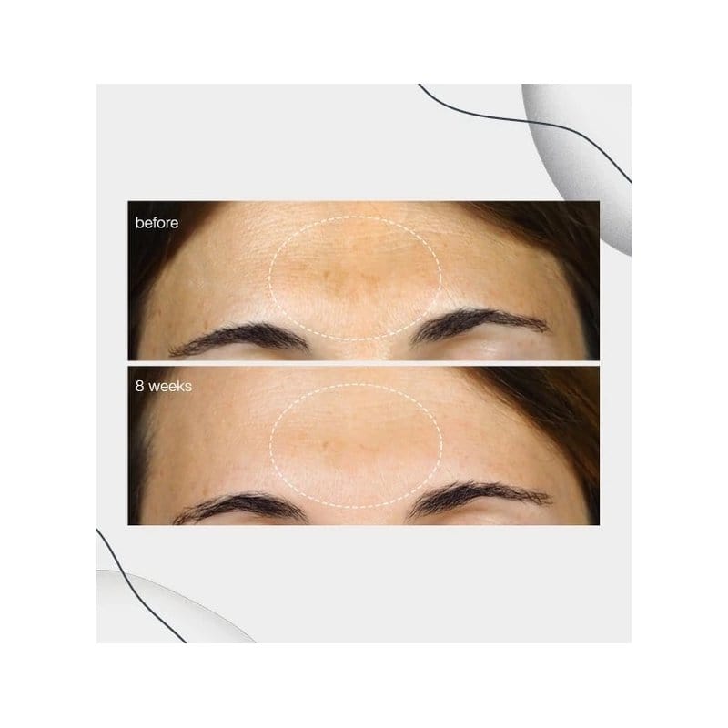 Dermalogica PowerBright Koyu Lekeler İçin Bakım Serumu 30 ml