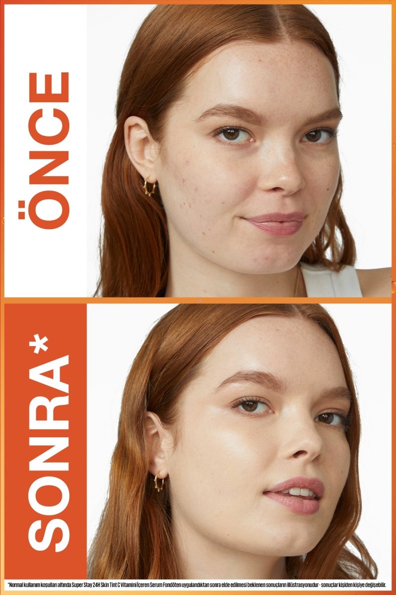 Maybelline Super Stay Skin Tint Fondöten - 40