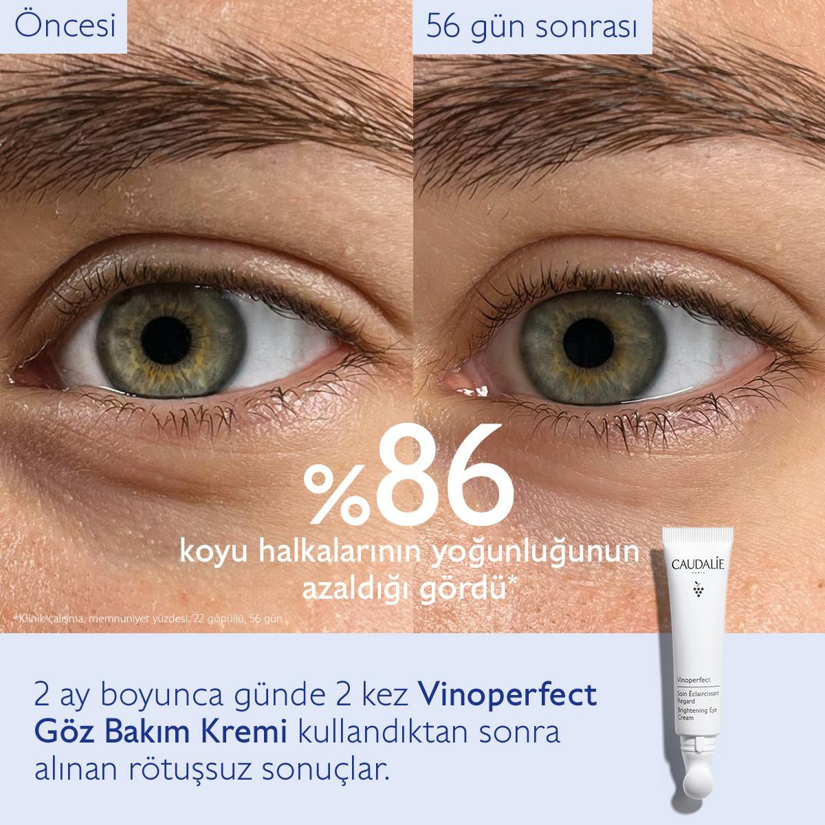 Caudalie Vinoperfect Işıltı Verici Göz Bakım Kremi 15 ml