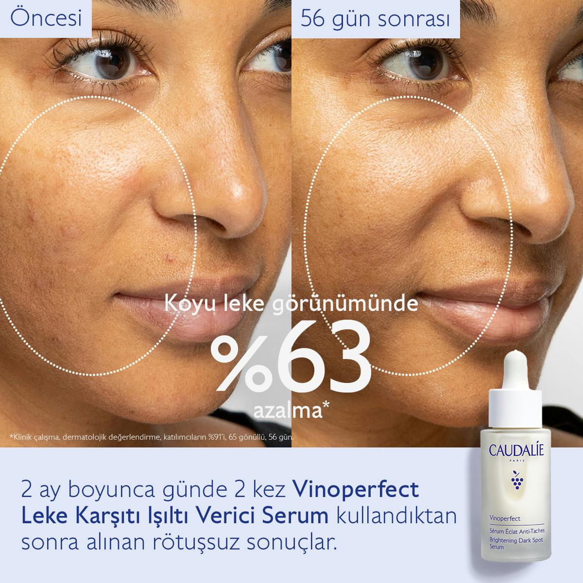 Caudalie Vinoperfect Leke Karşıtı ve Işıltı Verici Serum 30 ml