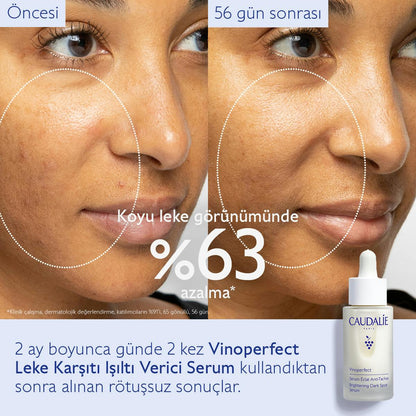 Caudalie Vinoperfect Leke Karşıtı ve Işıltı Verici Serum 30 ml
