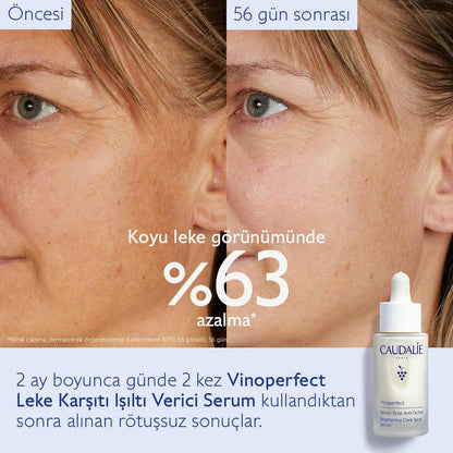 Caudalie Vinoperfect Leke Karşıtı ve Işıltı Verici Serum 50 ml