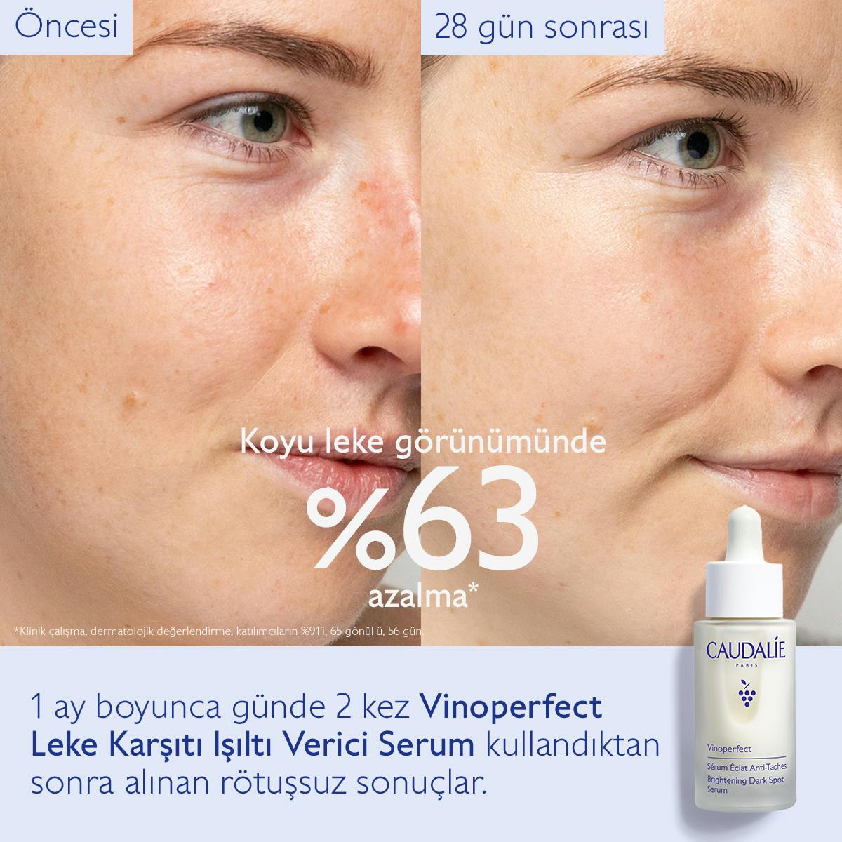 Caudalie Vinoperfect Leke Karşıtı ve Işıltı Verici Serum 50 ml