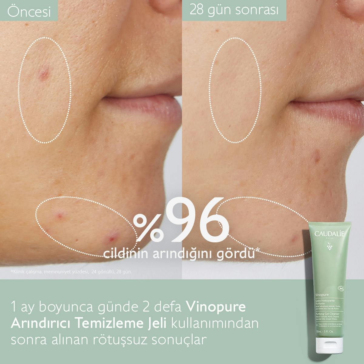 Caudalie Vinopure Arındırıcı Temizleme Jeli 150 ml