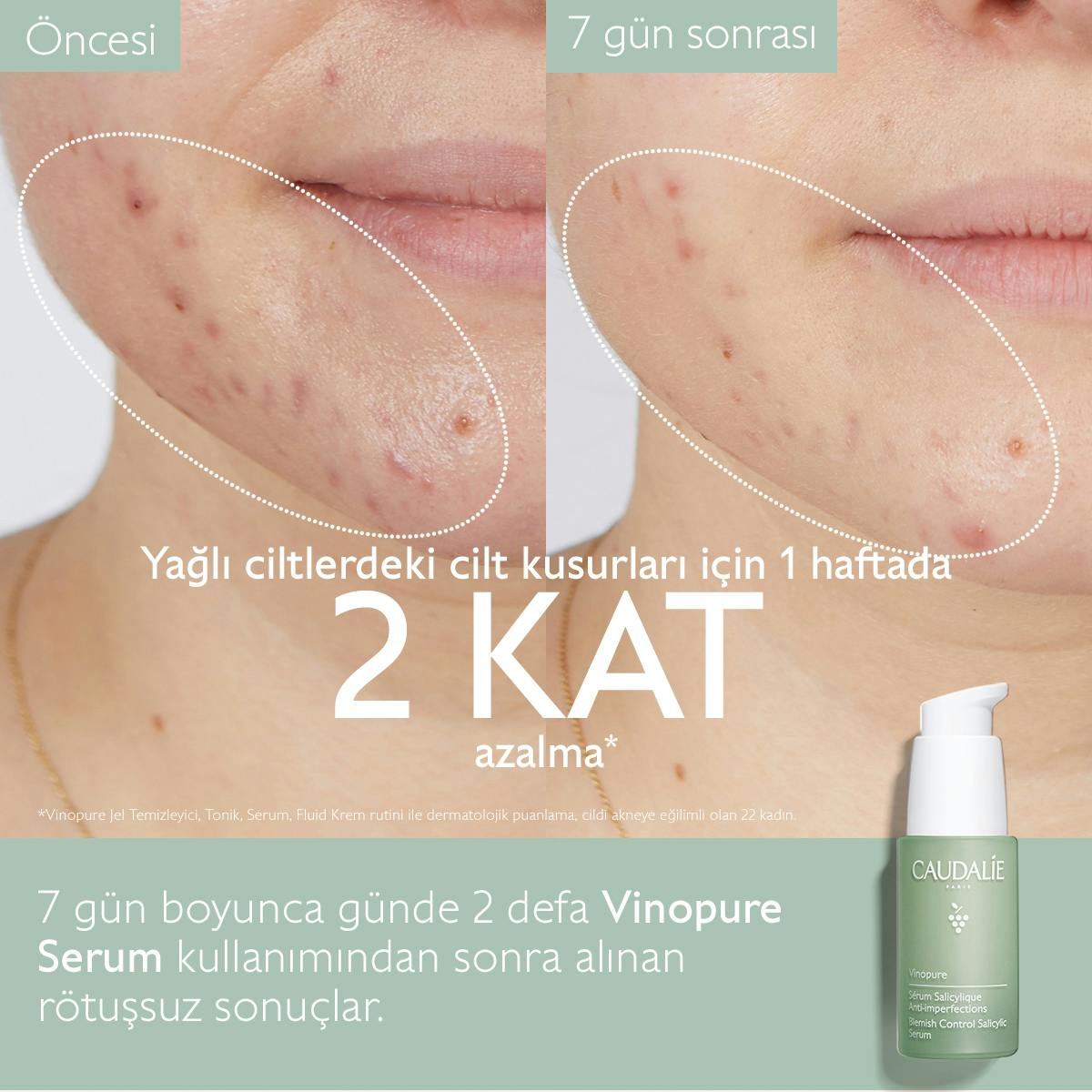 Caudalie Vinopure Blemish Control Salicylic Serum 30 ml