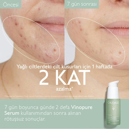Caudalie Vinopure Blemish Control Salicylic Serum 30 ml