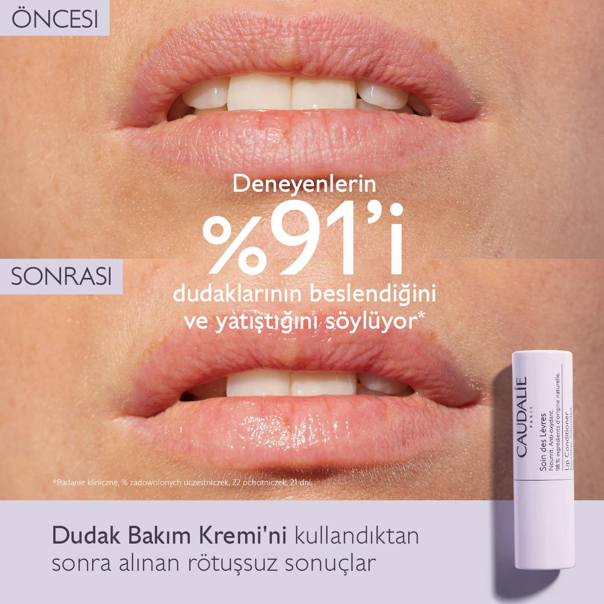 Caudalie Vinoterapist Soin Des Levres Dudak Bakım Kremi 4.5 g