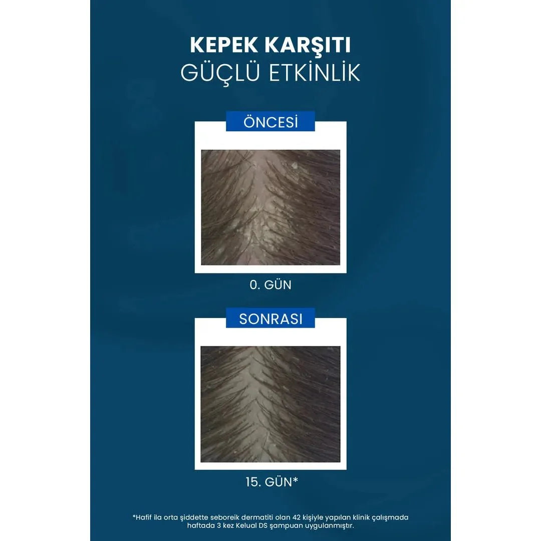 Ducray Kelual DS Shampoo Kepek Karşıtı Şampuan 100 ml
