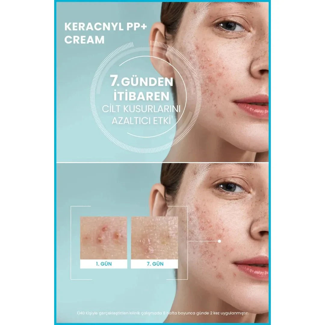Ducray Keracnyl PP+ Akneye Eğilimli Ciltler İçin Bakım Kremi 30 ml