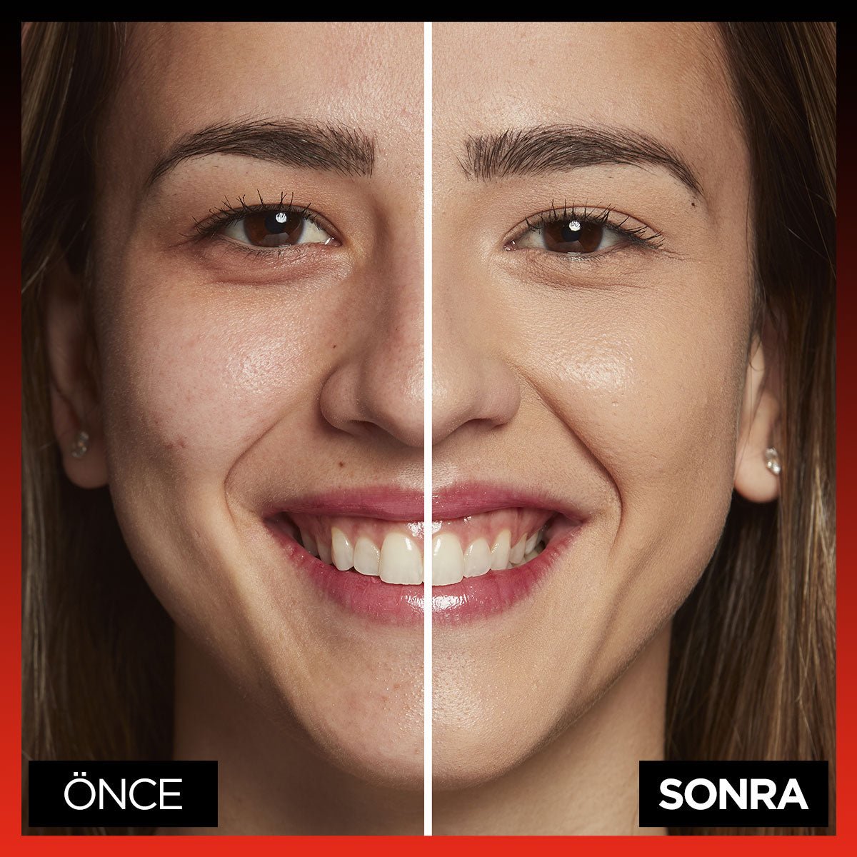 Loreal Paris Infaillible 24H Tüm Yüze Uygulanabilir Kapatıcı - 330 Pecan