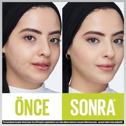 Maybelline New York Super Stay 30H Kapatıcı - 10 FAIR