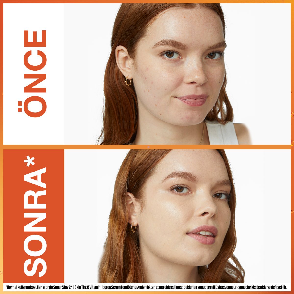 Super Stay Skin Tint Fondöten - 10